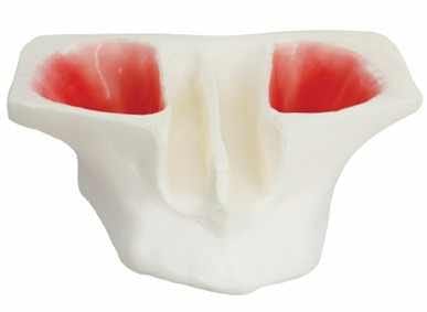 Resin Sinus Lift Model