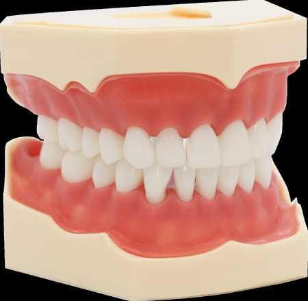 Zahnmodell in Naturfarbe mit Gingiva – Navadha Enterprises, Diagnostik