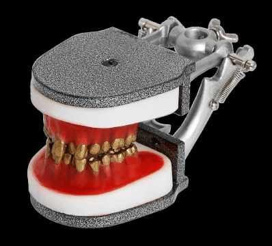 Typodonte orthodontique avec dents métalliques – Navadha Enterprises, Diagnostics