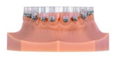 printodent GR-18.3 IB – pro3dure medical, 3D Printing Resins