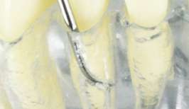 Curette GRACEY GRA 1/2 Standard