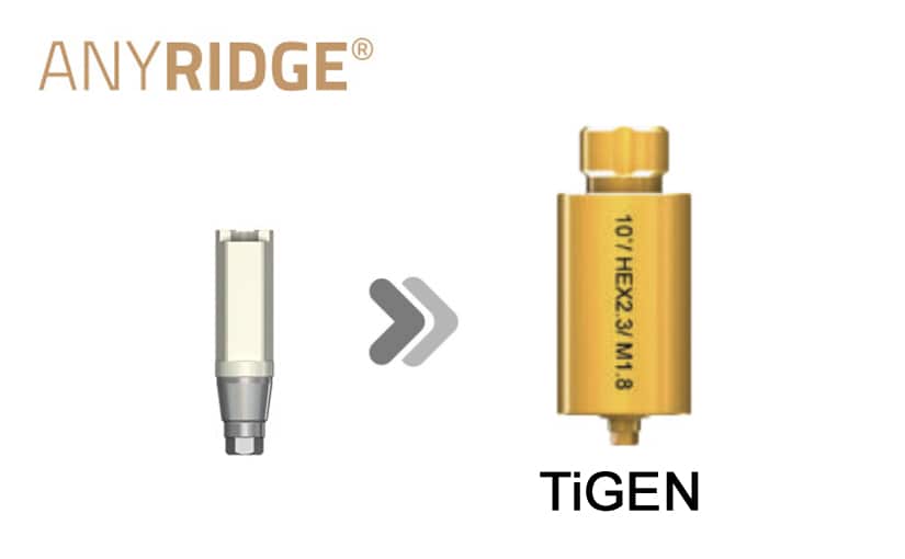 AnyRidge TiGEN (Pre-milled)