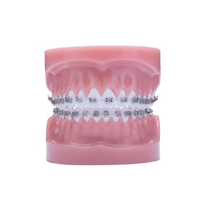 Razor Typodont - Piece – IOS International Orthodontic Services, Intraoral Appliances