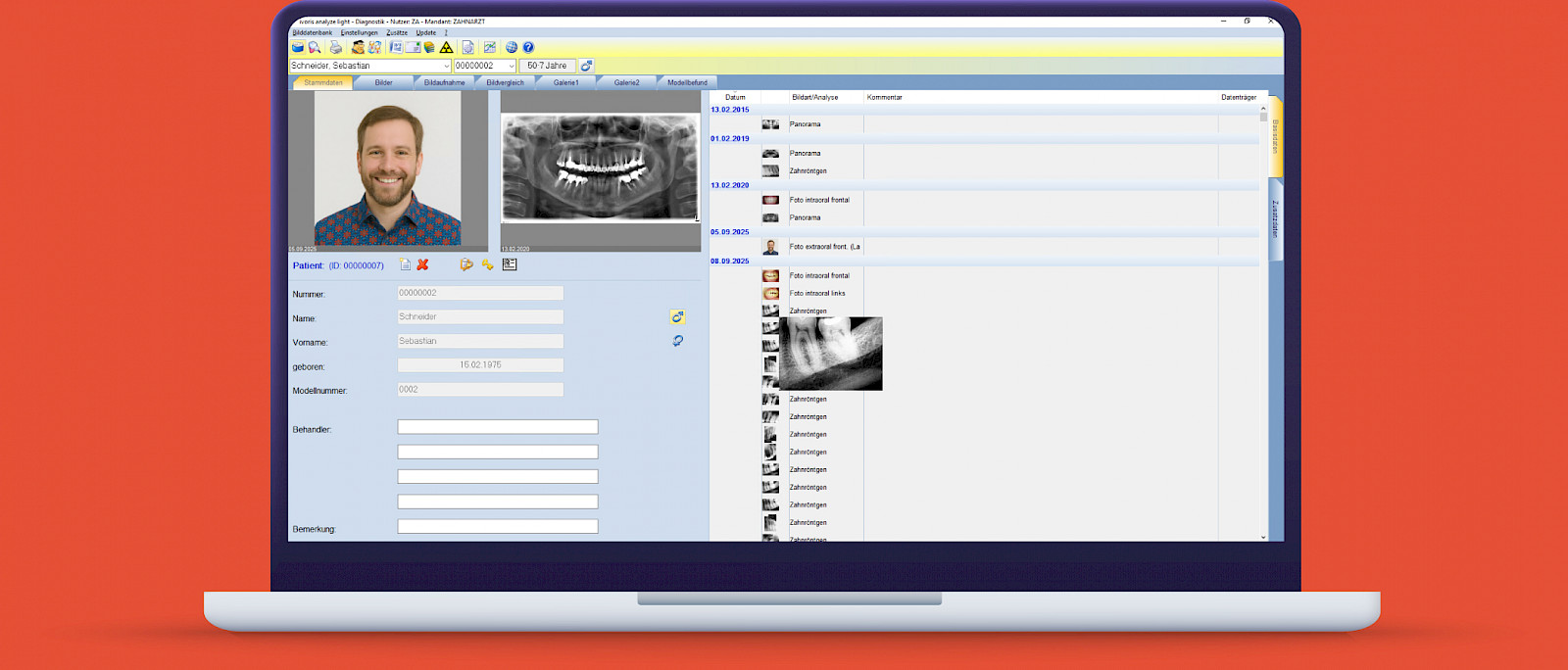 ivoris® analyze light