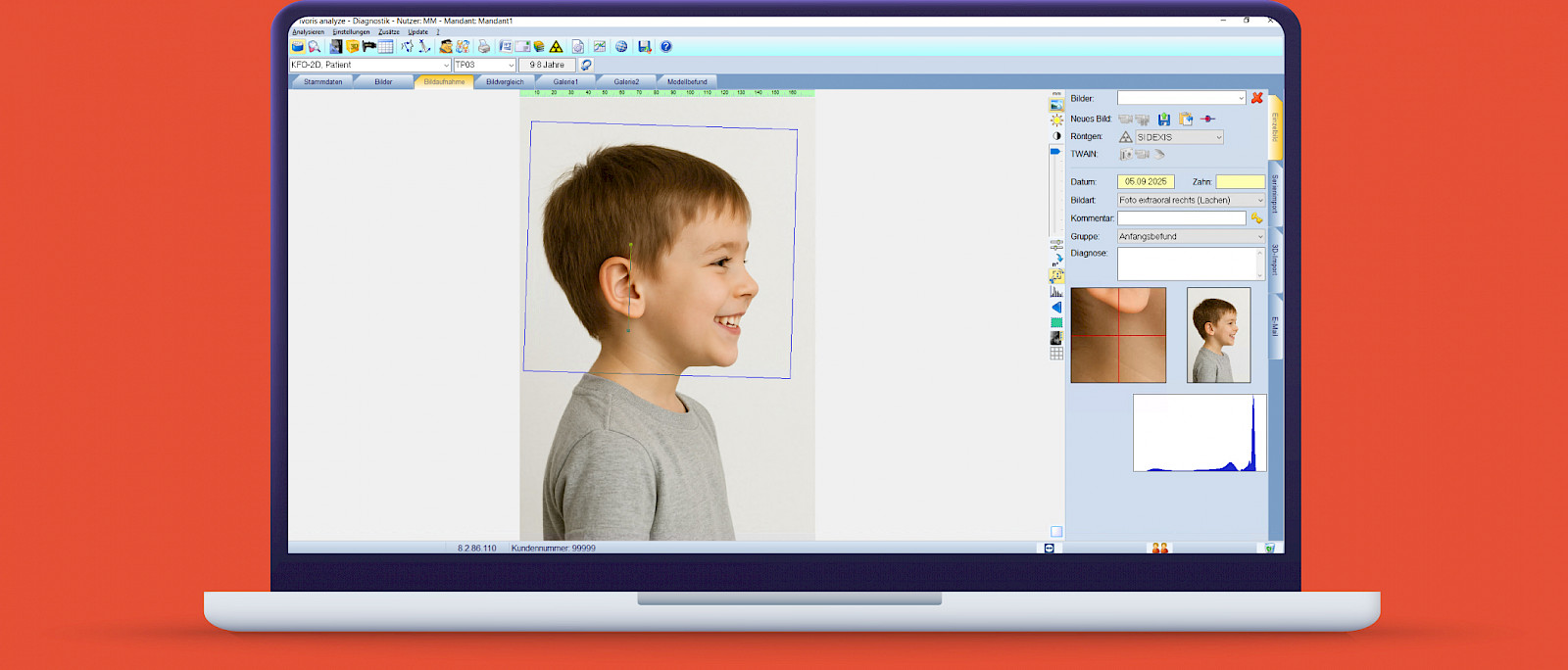 ivoris® analyze express