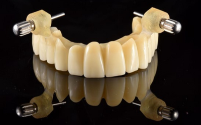 Remount Guide – Krausz Dental Lab, Implant Surgical Kits