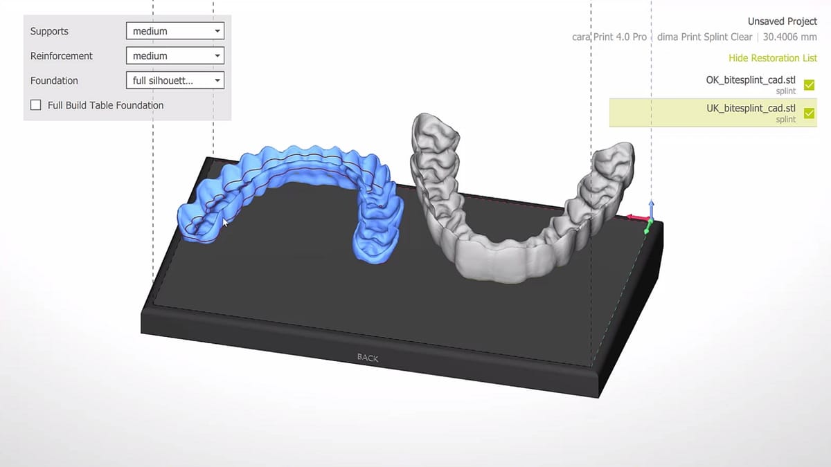 cara® Print CAM 2.0 – Kulzer, CAD/CAM Software