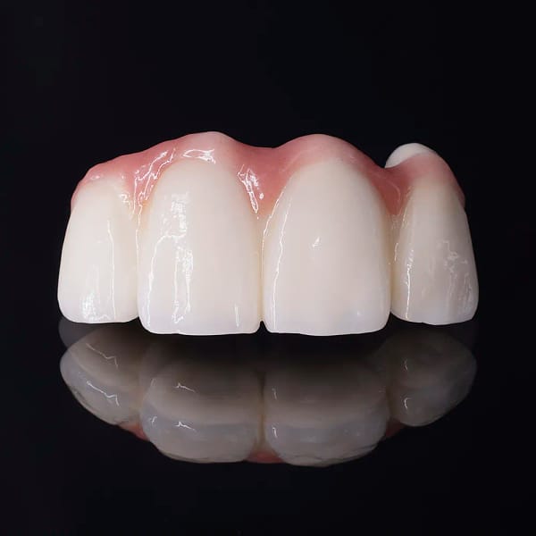 Couronne en zirconium monolithique