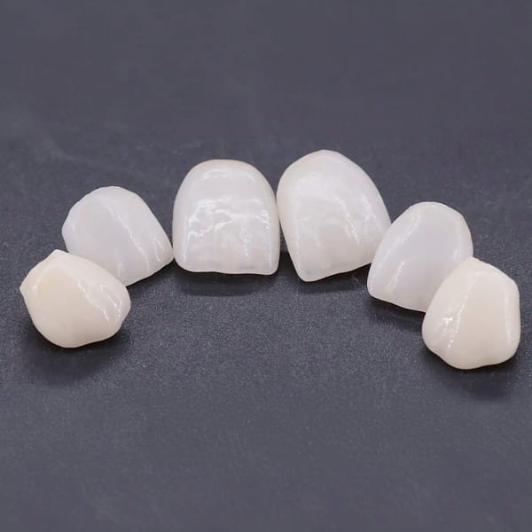 Couronne E-Max avec cut-back