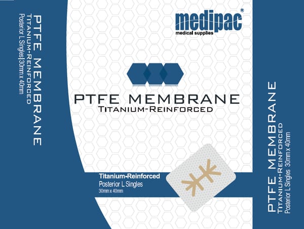 Posterior L Singles