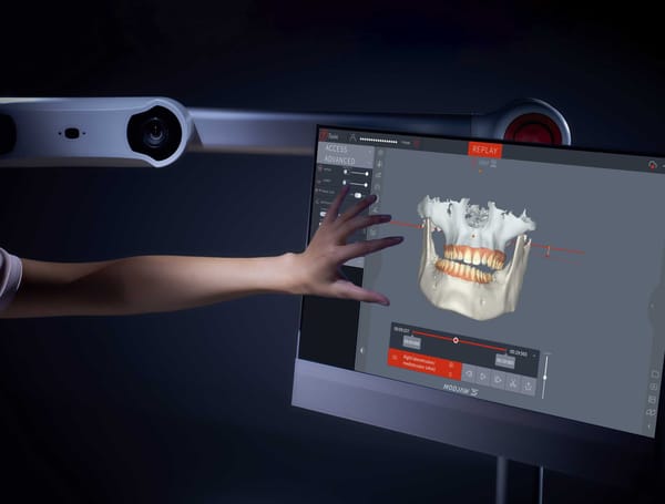 Modjaw™ - solution ALL in ONE