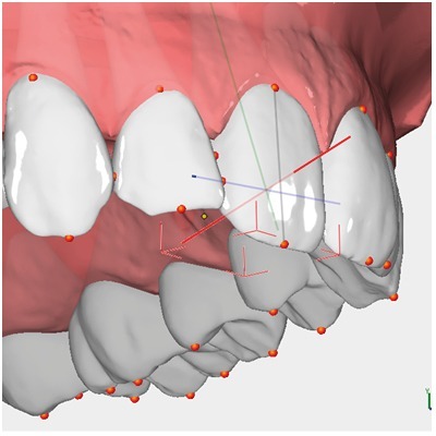 OnyxCeph™ 3D