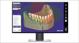 Exocad