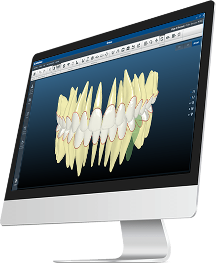 Insignia™ - Customized Digital Orthodontic Bracket System