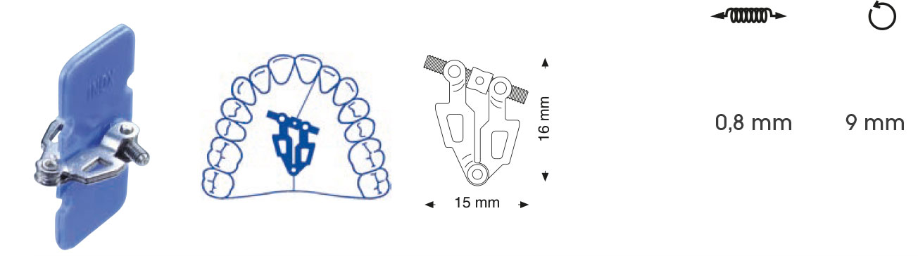 Vis d'expansion en éventail asymétrique – Orthobasics GmbH & Co. KG, Intraoral Appliances