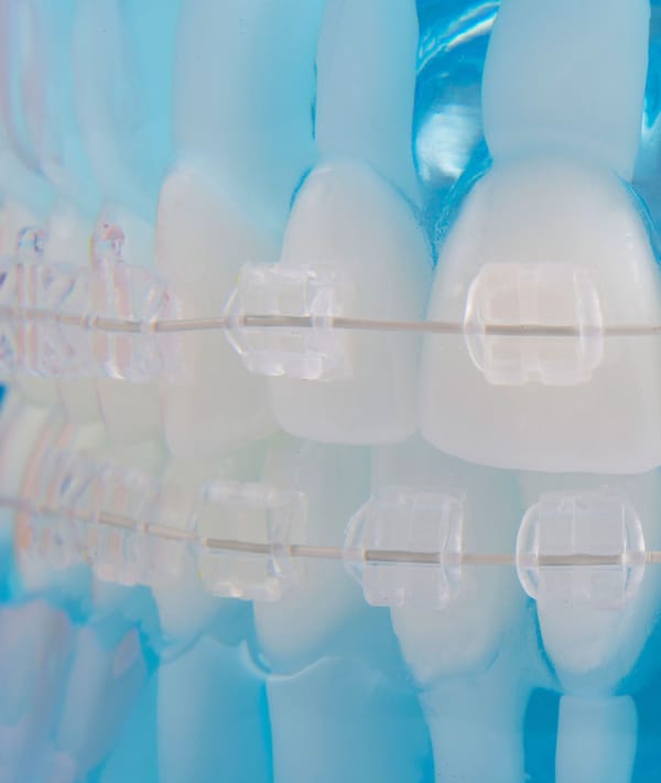 Clear Bracket