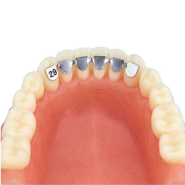 Kleberetainer Eckzahn zu Eckzahn – Orthobasics GmbH & Co. KG, Patientenversorgungsprodukte