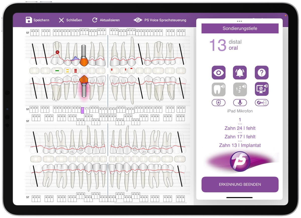 PS Voice – KI-Sprachsteuerung der neuesten Generation – ParoStatus.de GmbH, CAD/CAM-Software