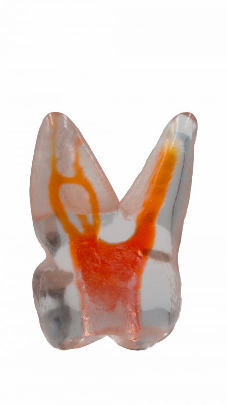 TrueTooth - Molar