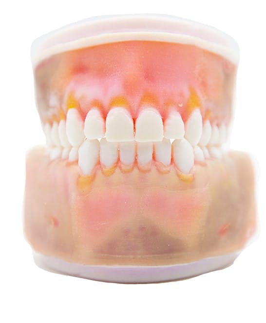 TrueTooth – Prämolar