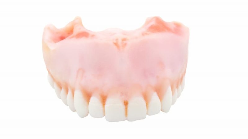 TrueJaw Extraktion Oberkiefer – PlanB Dental, Keramikmaterialien