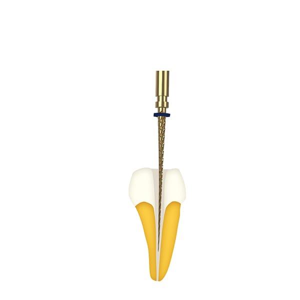 Dentaler Endomotor JS300 – Foshan Jerry Medical Apparatus Co., Ltd, Geräte