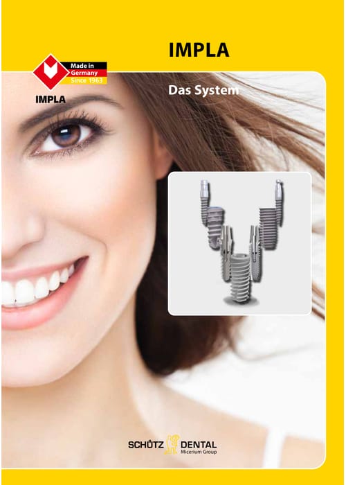 Exoplan Software mit Guide Creator – Schuetz-Dental, CAD/CAM Software