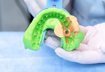 Porte-empreinte de photopolymérisation individuel grand format – Shandong Huge Dental Material Corporation, Tray Materials