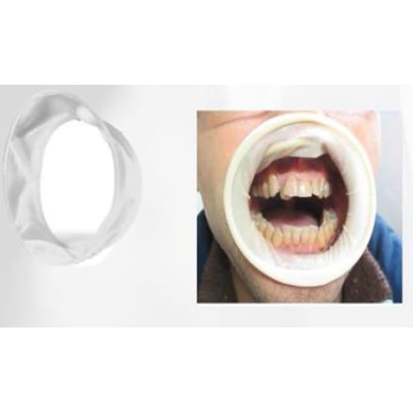 Rubber Mouth Gap (sterilized by EO) AO10402