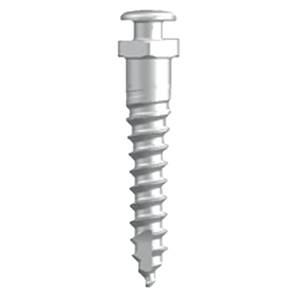 EXCALIBUR