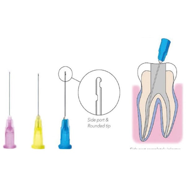 Endo-Spülnadeln (beidseitig gekerbt, geschlossenes Ende, runde Spitze, 1") – THOMSEN DENTAL PTY LTD, Spritzen