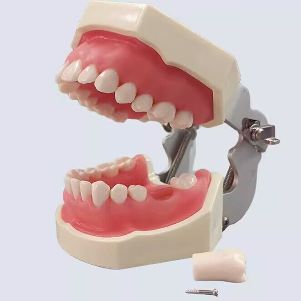 Standard Model with 28 Screw-in Teeth – THOMSEN DENTAL PTY LTD, Demomodelle