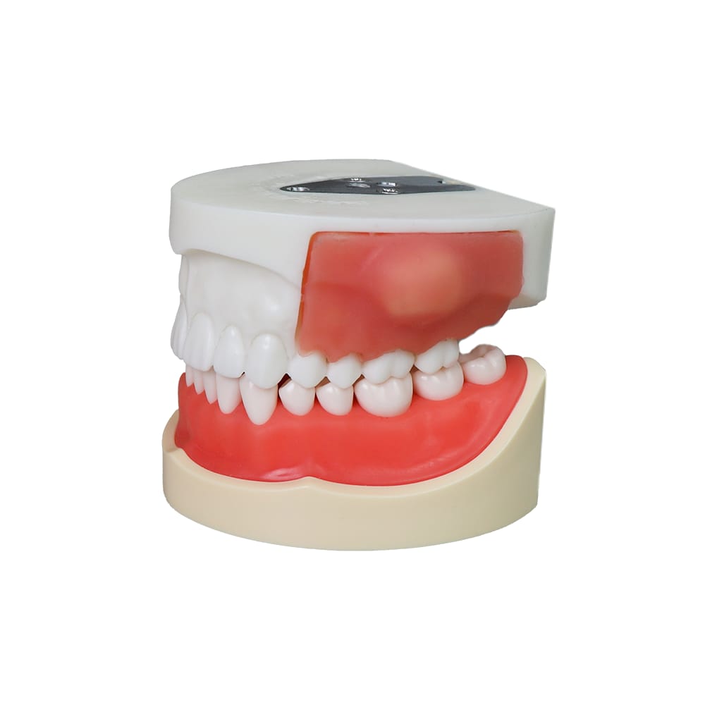 Cyst Incision Dental Model – 28 Teeth with Soft Gums and Upper Jaw Cyst Block JG-Y23 – FOSHAN JINGLE MEDICAL EQUIPMENT CO.,LTD., Demonstration Models