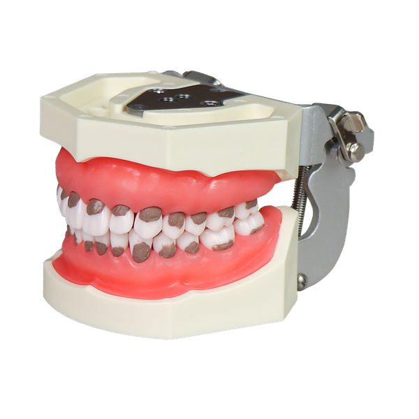 Asian Soft Gum Dental Calculus Model with FE Articulator – Removable Teeth for Scaling Practice JG-Y6-F
