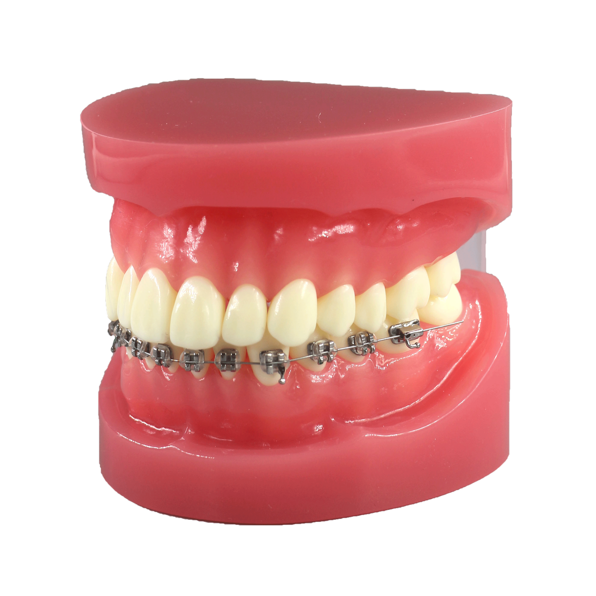 Orthodontic Demonstration Model JG-Y7-Y – 28 Teeth, Optional Brackets – FOSHAN JINGLE MEDICAL EQUIPMENT CO.,LTD., Demonstration Models