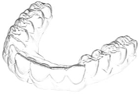 Smilemaker Clear-Aligner-Drucker