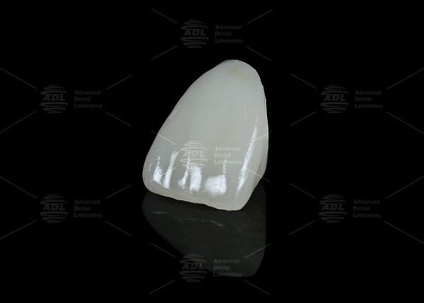 China Dental Lab Hybrid Ceramic Vita Enamic Dental with Translucency for Single Tooth Restorations