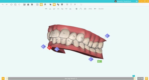 Smile Plus