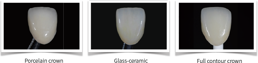 Aidite Stain/Glaze