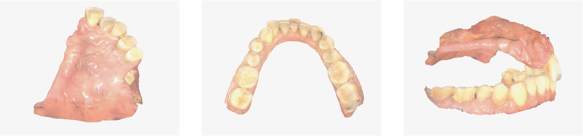 Aidite Cameo Rapid 3