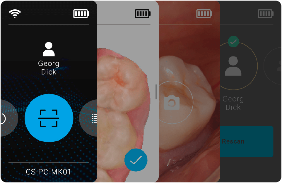CS.Nova Intraoralscanner