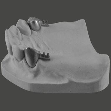Klebeverbindungen Set 18 Stk – CHARMING Dentalprodukte GmbH, Waxes
