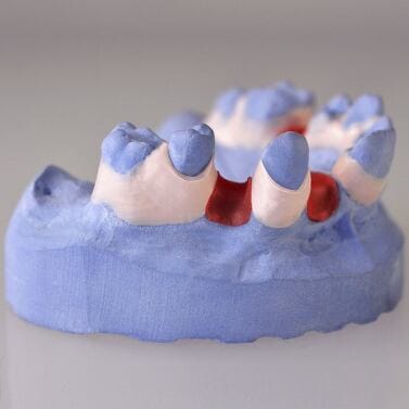 Ausblockwachs Rosa – CHARMING Dentalprodukte GmbH, Wachse