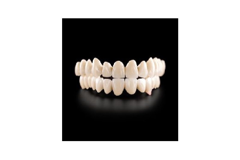 Lithium Disilicate (Glass Ceramic)