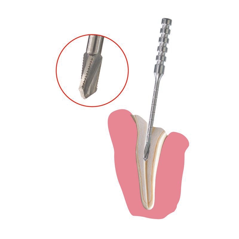 rootEX® – Diaswiss SA, Chirurgische Instrumente