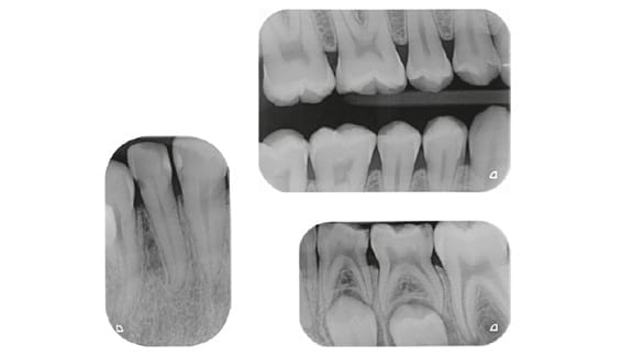 VistaScan Nano Easy