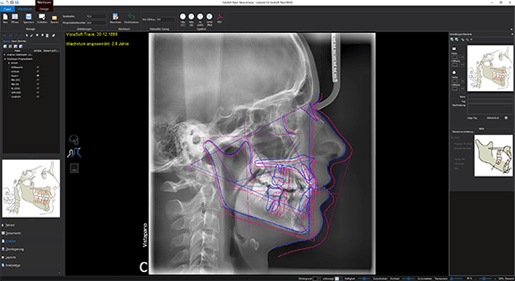 VistaSoft Trace – Dürr Dental, Software