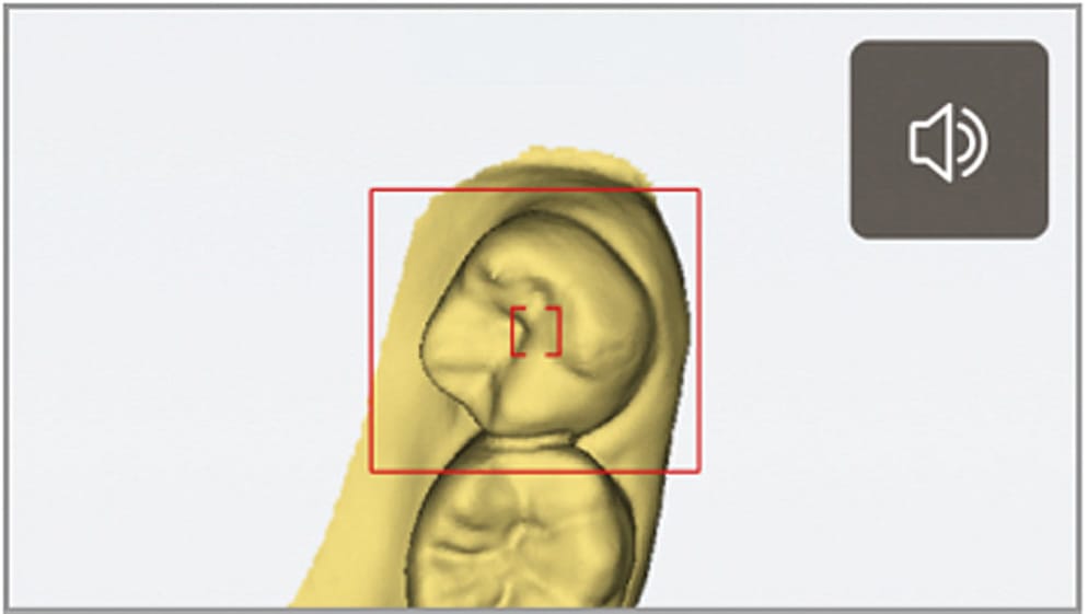 AS 200E kabellos – F1 Dentalsysteme GmbH, Intraoralscanner