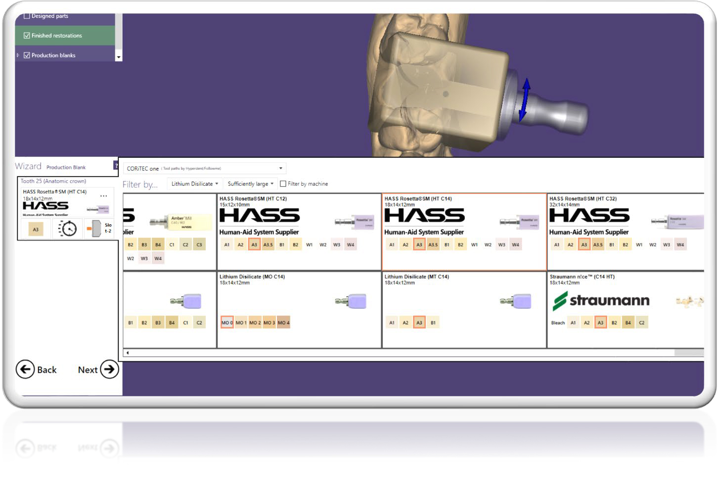 hyperDENT exocad Connect