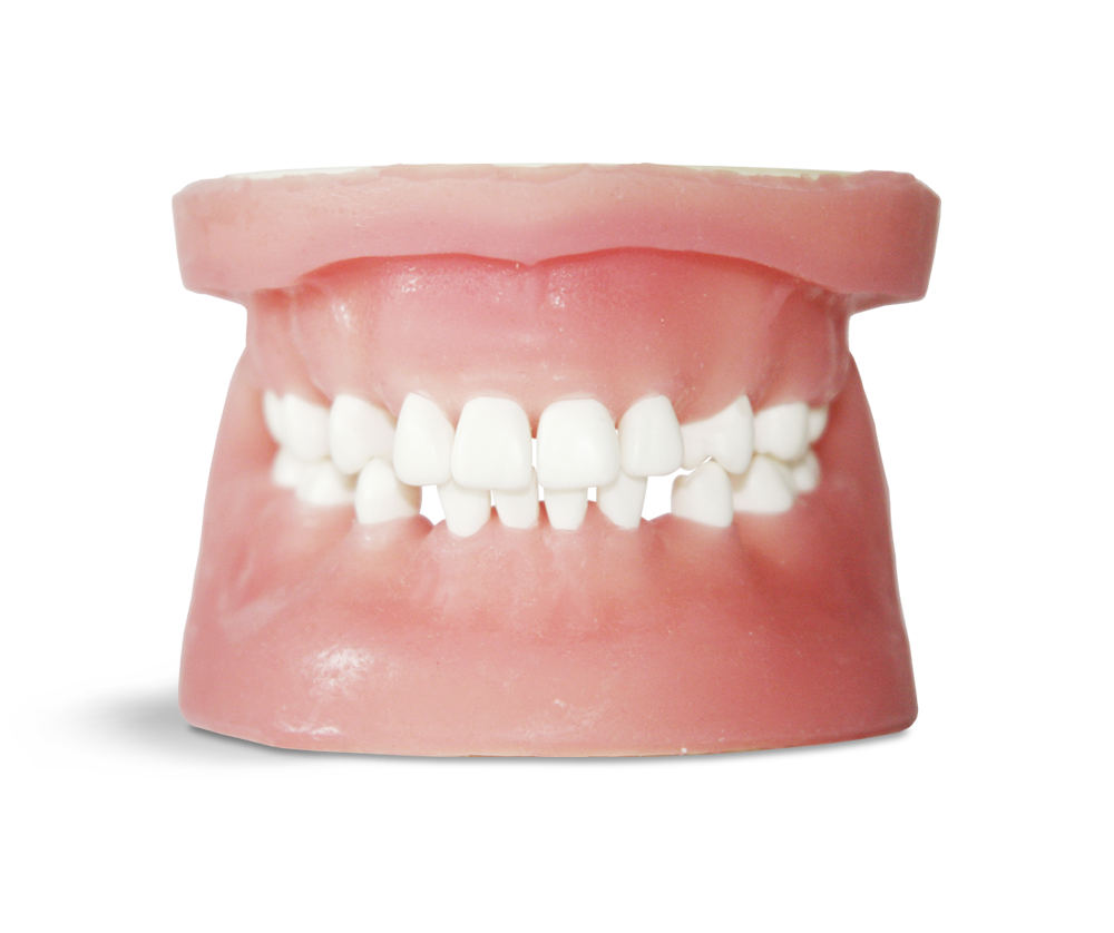 E34 - Modèle pour entraînement chirurgical en matériau synthétique – GF Dental di Ficuciello Antonino, Gypsum Additives, Die Hardeners and Plaster Removers